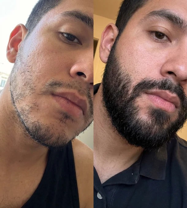 Super Strength Minoxidil 20% Beard Growth and Repair Cream | 100 milliliters