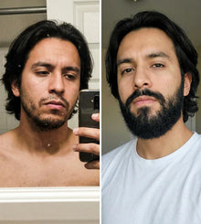 Super Strength Minoxidil 20% Beard Growth and Repair Cream | 100 milliliters